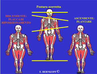 Problematiche posturali ascendente e discendente